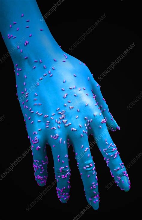 Bacterial Contamination Stock Image C0083063 Science Photo Library