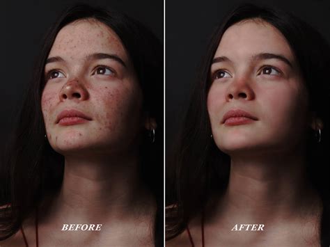 Photo Retouching Skin Retouch Before And After By Viktorgjokaj On