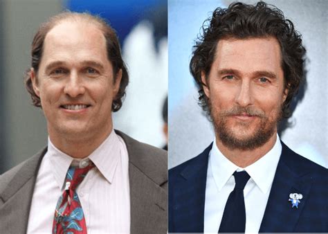 Male Celebrities Who Wear Toupees And Wigs Due To Hair Loss 2023