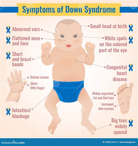 Down Syndrome Symptoms Diagram