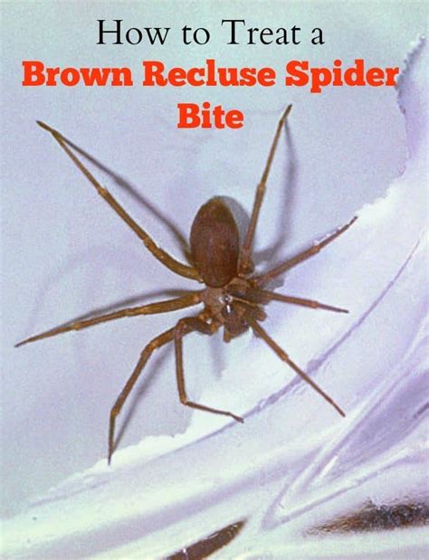 How To Treat A Brown Recluse Spider Bite