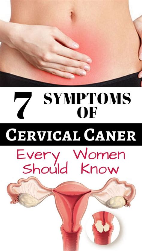 The human papillomavirus is the most common cause of cervical cancer. Cervical cancer symptoms - Gotta check this