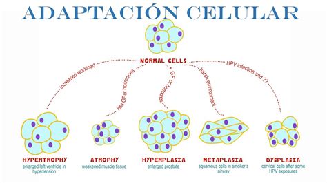 Adaptaciones Celulares Hipertrofia Hiperplasia Atrofia Metaplasia The