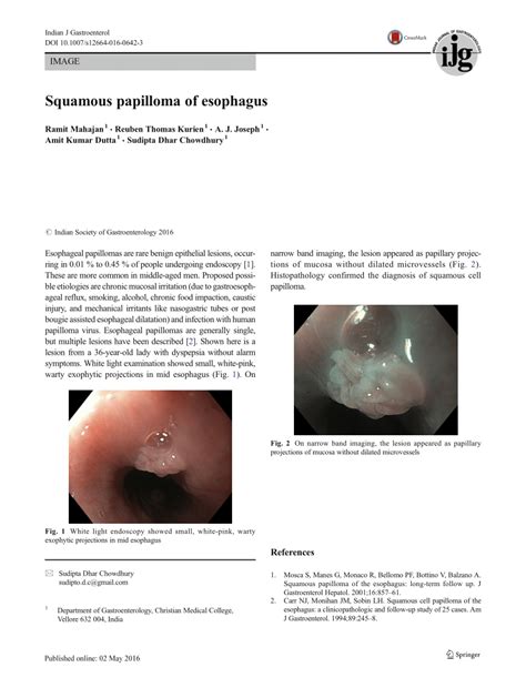PDF Squamous Papilloma Of Esophagus