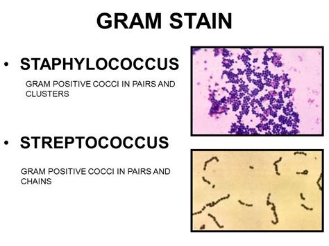 Gram Positive Cocci In Pairs And Clusters Cloudshareinfo