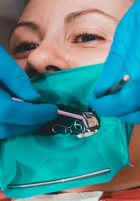 Soft Tissue Grafting Smile Dental Arts Centre