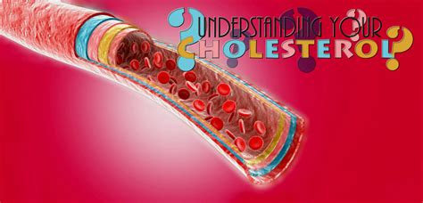 5 Easy Ways to Reduce Cholesterol Levels without Drugs