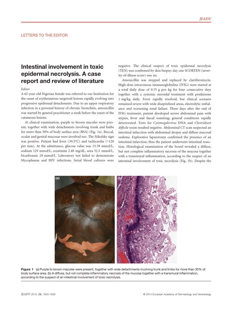 Pdf Intestinal Involvement In Toxic Epidermal Necrolysis A Case