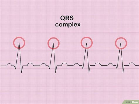 How To Calculate Heart Rate In Bigeminy Haiper