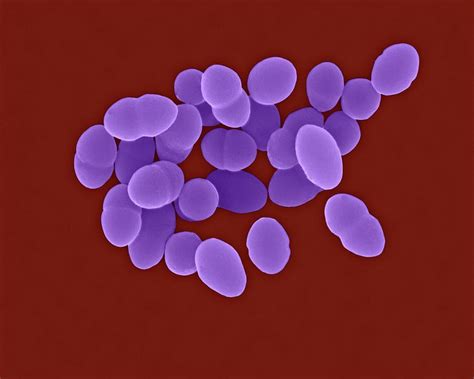 Streptococcus Pneumoniae Photograph By Dennis Kunkel Microscopyscience