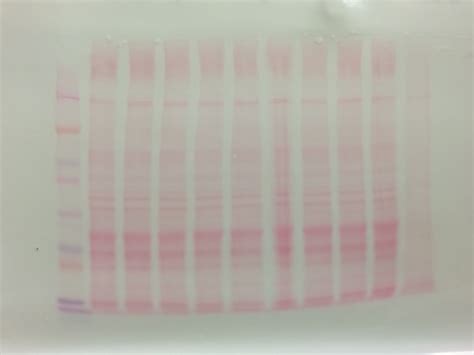 What Are The Causes Of A Bad Western Blot Result Researchgate