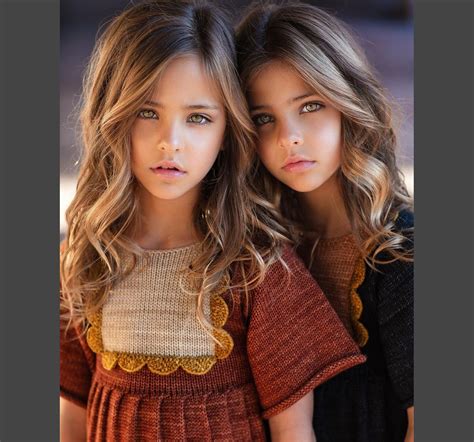 10 Years Ago They Were Called The Worlds Most Beautiful Twins Now Look At Them Page 30 Of