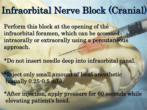 Ppt How To Administer Dental Nerve Blocks A Training Guide Powerpoint