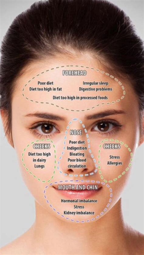 Acne Chart Learnmoreaboutskincare Skin Face Mapping Acne Skin