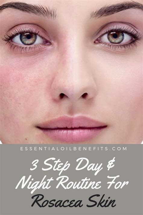 3 Step Day And Night Routine For Rosacea Skin Skincarebeautyproducts