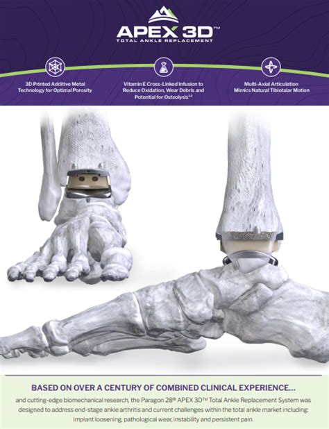 Surgeon — Apex 3d™ Total Ankle Replacement System