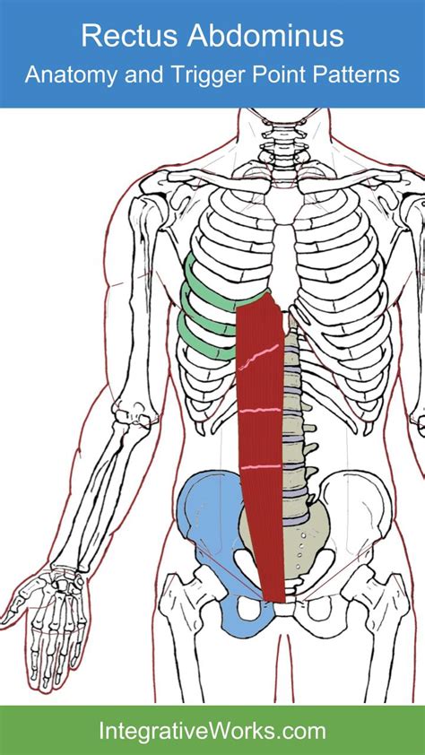 Trigger Points Wide Band Of Pain Across The Top Of The Hips