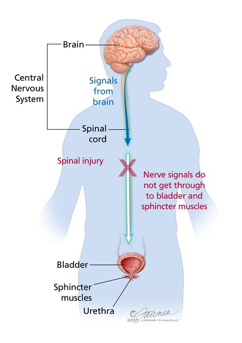 Neurogenic Bladder Symptoms Diagnosis Treatment Urology Care
