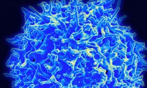 New Skin Cancer Drug Uses Bodys Own Killer Cells To Make Tumour
