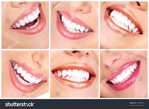 Beautiful Young Woman Teeth Close Up Stock Photo 25356697 Shutterstock