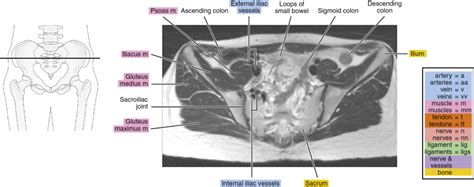 Pelvis Muscles Mri Anatomy The Pelvis Radiology Key Functional Bank Home Com