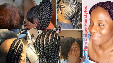ROCK IT THIS WAYUnique Trendy Braids Hairstyles Ideas For Hair Loss Black Women Natural