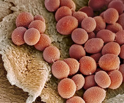 Fungal Spores Sem Photograph By Steve Gschmeissner