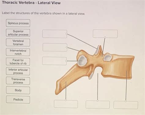 Solved Thoracic Vertebra Lateral View Label The Structures Chegg Com