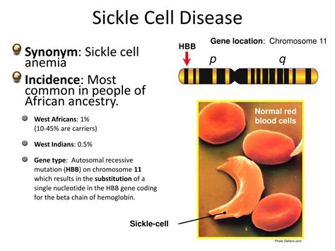 View Chromosome 11 Sickle Cell Anemia Mutation Us Debbie J Vaughn