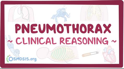 Clinical Reasoning Pneumothorax Osmosis Video Library