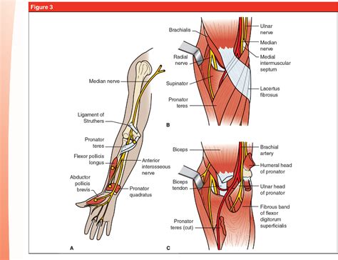 Figure From Ulnar Tunnel Syndrome Radial Tunnel Syndrome Anterior Interosseous Nerve