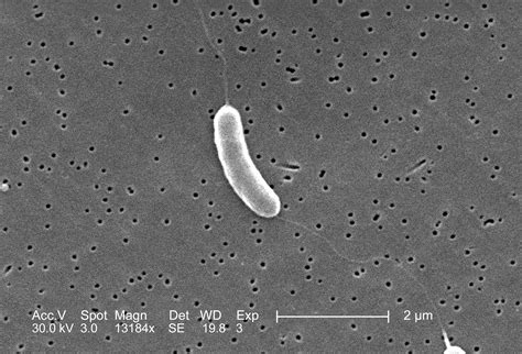 Free Picture Flagellated Vibrio Vulnificus Bacterium