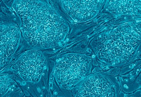 Stem Cells Stem Cells Curing Type 1 Diabetes