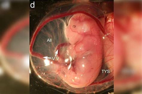 Berikut deskripsi bagaimana bayi tumbuh dalam tiap pekan. Proses perkembangan janin dari usia kehamilan 1 bulan ...