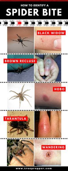 25 Bästa Spider Bites Idéerna På Pinterest