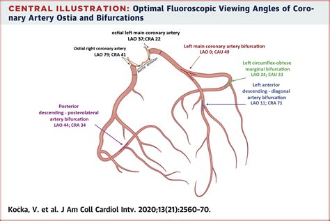 Optimal Fluoroscopic Projections Of Coronary Ostia And Bifurcations