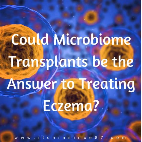 Could Microbiome Transplants Be The Answer To Treating Eczema How To