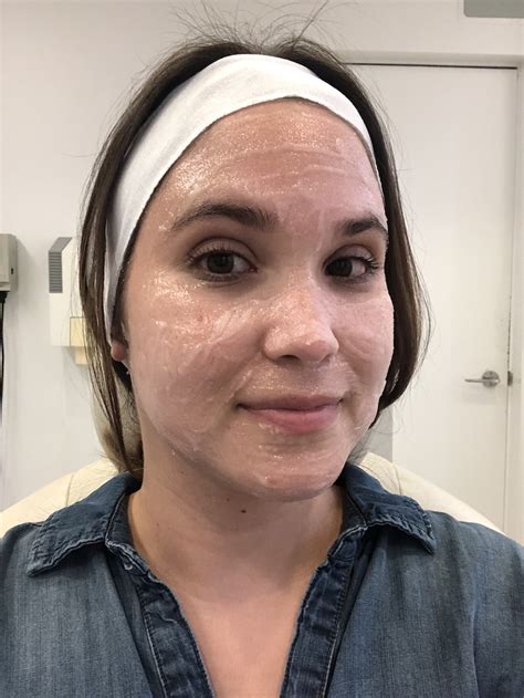 Clear Brilliant Laser Skin Care Treatment Honest Review Hellogiggles