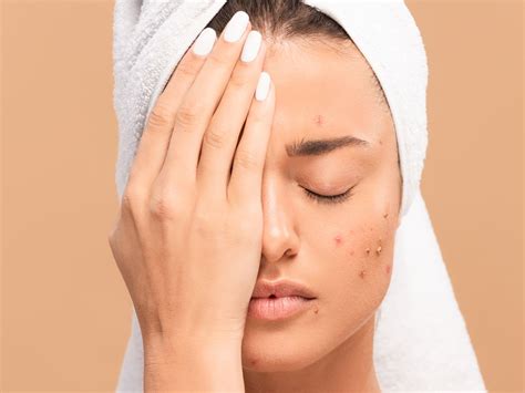 How Stress Can Affect Your Skin Skin Care Top News