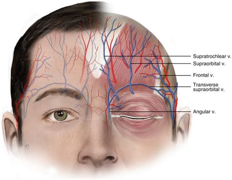 Forehead Plastic Surgery Key