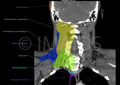 Ct Scan Of Head And Neck E Anatomy