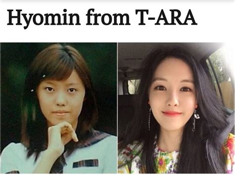 K Pop Stars Before And After Plastic Surgery K Pop Amino