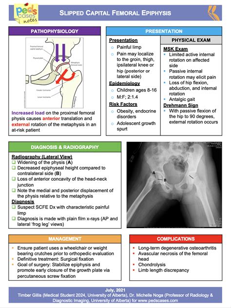 Slipped Capital Femoral Epiphysis Pedscases