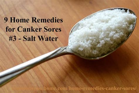 9 Home Remedies For Canker Sores And Tips To Avoid Canker Sore Triggers