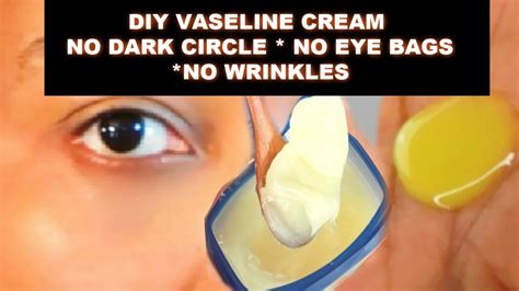 How I Remove Under Eyes Wrinkles Dark Circles Puffy Eyes And Eye