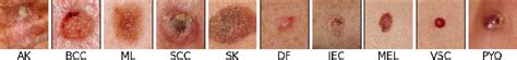 Figure 1 From Deep Features To Classify Skin Lesions Semantic Scholar