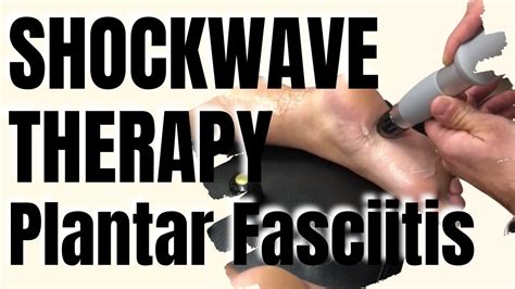 Shockwave Therapy For Plantar Fasciitis San Diego Shockwave Clinic