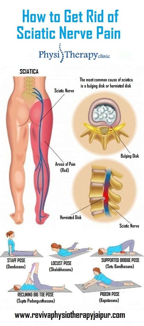 Where Is Sciatic Pain Felt Cares Healthy