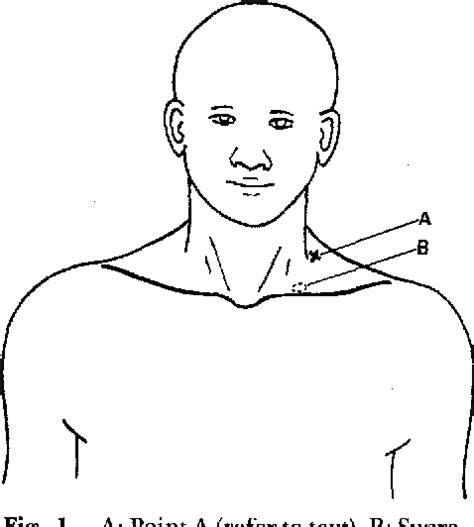 Figure 1 From Springing Test For Differentiating A Cervical Rib Tip