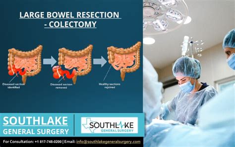 Large Bowel Resection Colectomy Procedure Southlake General Surgery